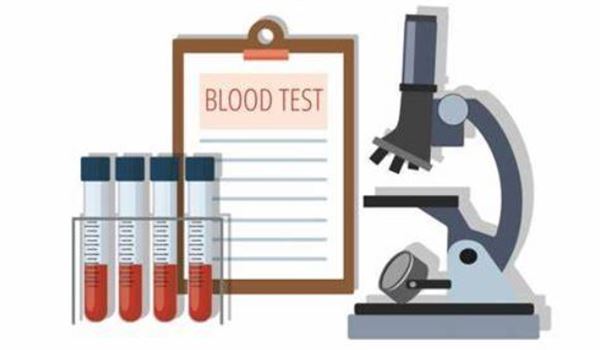 Test Results